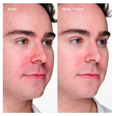 Clinique Anti-Blemish Solutions Clinical Gel Anti-Imperfections 20 ml