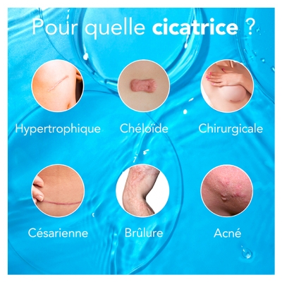 Kelo-Cote Traitement des Cicatrices 30 g
