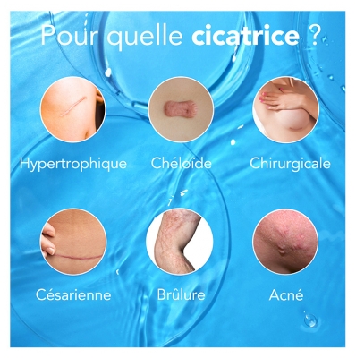 Kelo-Cote Traitement des Cicatrices 15 g