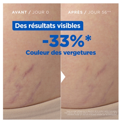 Mixa Expert Peau Sensible Huile Anti-Vergetures 100 ml