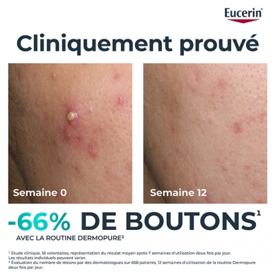 Eucerin DermoPure Sérum Triple Action 40 ml