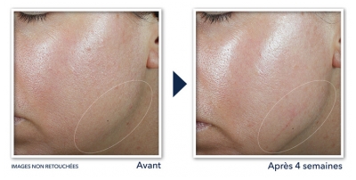 RoC Derm Correxion Crème Contour 50 ml