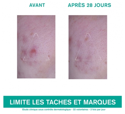 Uriage Hyséac 3-Regul + Soin Global Anti-Imperfections 40 ml