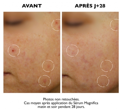 Sanoflore Sérum Magnifica Anti-Imperfections Bio 30 ml