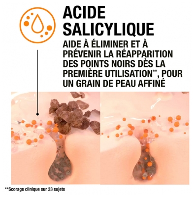 Neutrogena Crème Désincrustante Anti-Points Noirs 150 ml