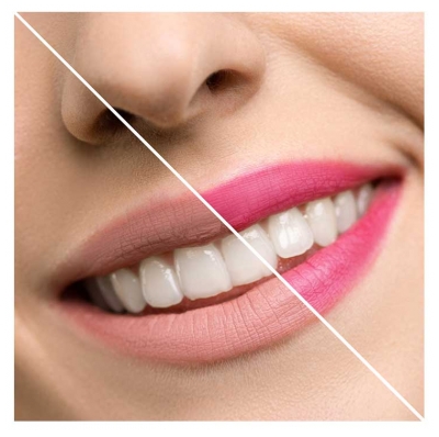 Inuwet Bloem in een Doosje Lippenbalsem 3 g