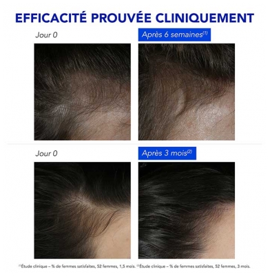 Phyto Phytophanère Traitement Antichute Réactionnelle 12 x 5 ml