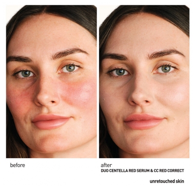 Erborian Centella Red Serum Soothing Concentrate 30 ml