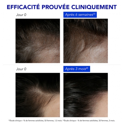 Phyto Phytophanère Traitement Antichute Réactionnelle 12 x 5 ml