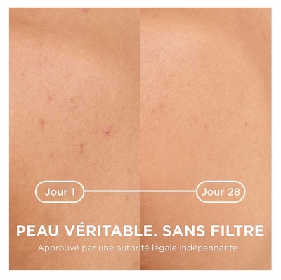 Bioderma Sébium Kerato+ Body Spray 150 ml