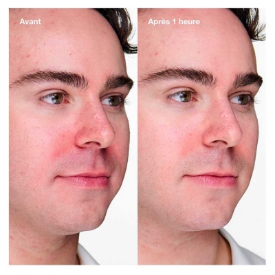 Clinique Anti-Blemish Solutions Clinical Gel Anti-Imperfections 20 ml