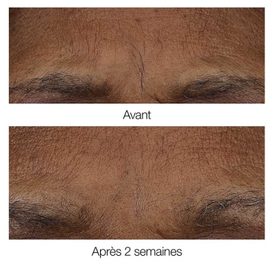 Clinique Smart Clinical Repair Baume Rétinoïde Matin/Soir 3 g