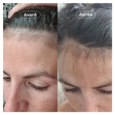 Omum x Chou2 Le Rituel Capillaire