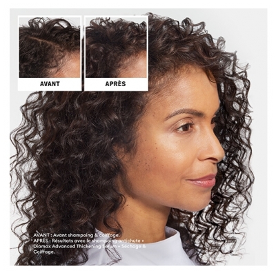 Nioxin Shampoing Anti-chute Nioxin 240ml