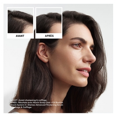 Nioxin Mini Kit Anti-chute System 3 Chute Modérée Cheveux Abîmés/Colorés