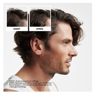 Nioxin Kit Anti-chute System 2 Chute Avancée Cheveux Naturels