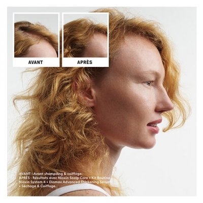 Nioxin Kit Anti-chute System 4 Chute Avancée Cheveux Abîmés/Colorés