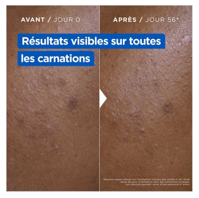 Mixa Crème Hydratante Niacinamide Correction Éclat 400 ml