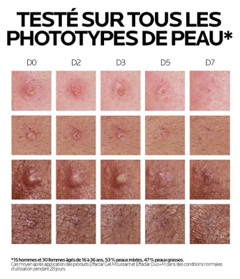 La Roche-Posay Effaclar Duo+M 40 ml