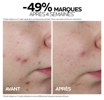 La Roche-Posay Effaclar Sérum Ultra Concentré 30 ml