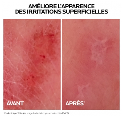 La Roche-Posay Cicaplast Baume B5+ 40 ml