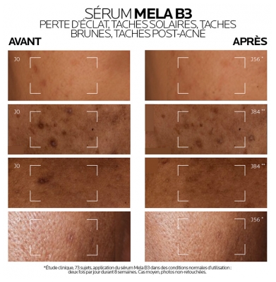 La Roche-Posay Mela B3 Sérum Concentré Anti-Taches 30 ml