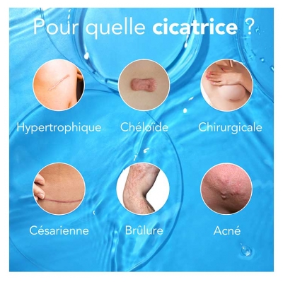 Kelo-Cote Traitement des Cicatrices 30 g