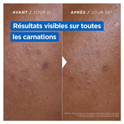 Mixa Crème Niacinamide Correction Éclat 400 ml