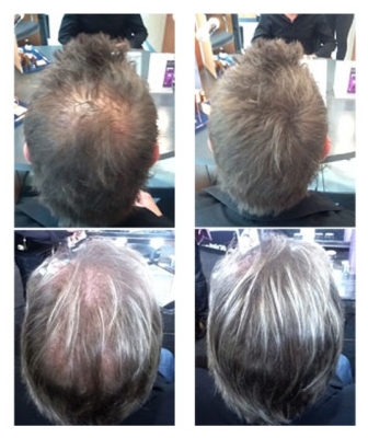 Hair 30 Hair30 Hair 30 chatain clair