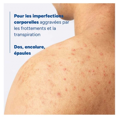 Ducray Keracnyl Spray Corps Asséchant Anti-Boutons 150 ml