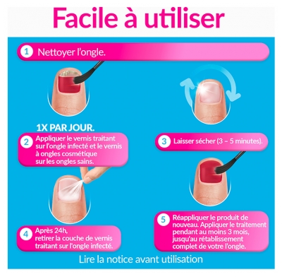 Excilor Excilor Forte Traitement Mycose de l'Ongle Coloré + Vernis Classique Coloré 30 ml