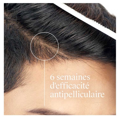 Neutrogena T/Gel Shampoing Antipelliculaire Pellicules Grasses 250 ml