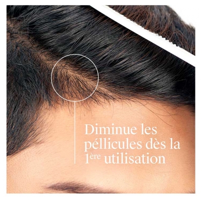 Neutrogena T/Gel Fort Shampoing Démangeaisons Sévères 250 ml