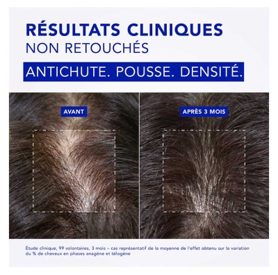 Phyto Phytocyane Chute de Cheveux 84 Gélules