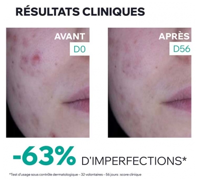 Uriage Hyséac 3-Regul + Soin Global Anti-Imperfections 40 ml
