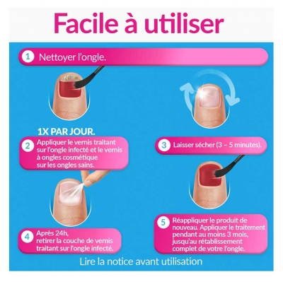 Excilor Excilor Forte Traitement Mycose de l'Ongle Coloré + Vernis Classique Coloré 30 ml