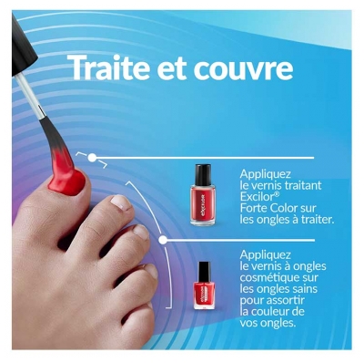 Excilor Excilor Forte Traitement Mycose de l'Ongle Coloré + Vernis Classique Coloré 30 ml