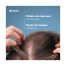 Ducray Anaphase Après-Shampoing Fortifiant Anti-Casse 200 ml