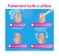 Excilor Easy Traitement Mycose de l'Ongle Déjaunissement Actif 4 ml