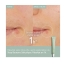 Caudalie Vinopure Stop Boutons Salicylique 15 ml