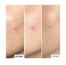 Erborian Centella SOS Anti-Imperfection Patch 9 ml