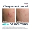 Eucerin DermoPure Sérum Triple Action 40 ml